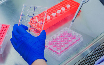 Microplate being filled with samples