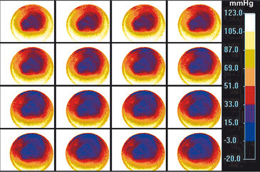 Time series O2 distribution images of cell culture