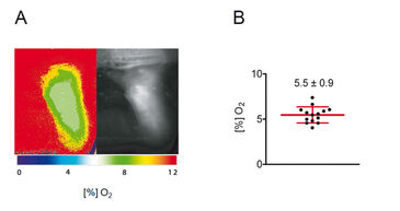 Determination of skin oxygenation with FLIM-based imaging technology